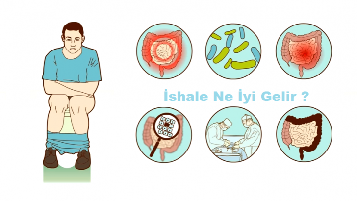 İshale Ne İyi Gelir ?