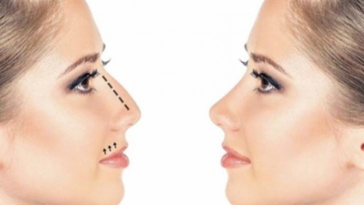 Burun Estetiği Nedir? Faydaları ve Bilinmesi Gerekenler